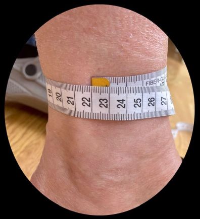 Ankle Size